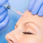 Natural Looking Botox Results Without a Frozen Appearance