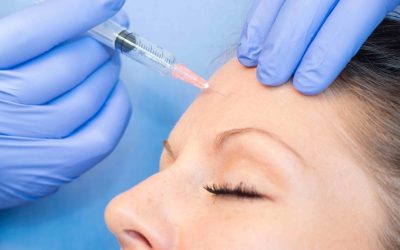 How to Get Natural Looking Botox Results Without a Frozen Appearance