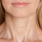 What Causes Neck Wrinkles and How to Treat Them in Potomac MD