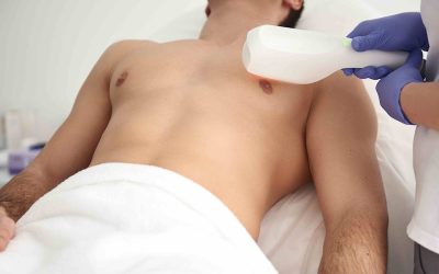 Chest Rejuvenation Treatments for Sun Damage and Wrinkles in Bethesda, MD