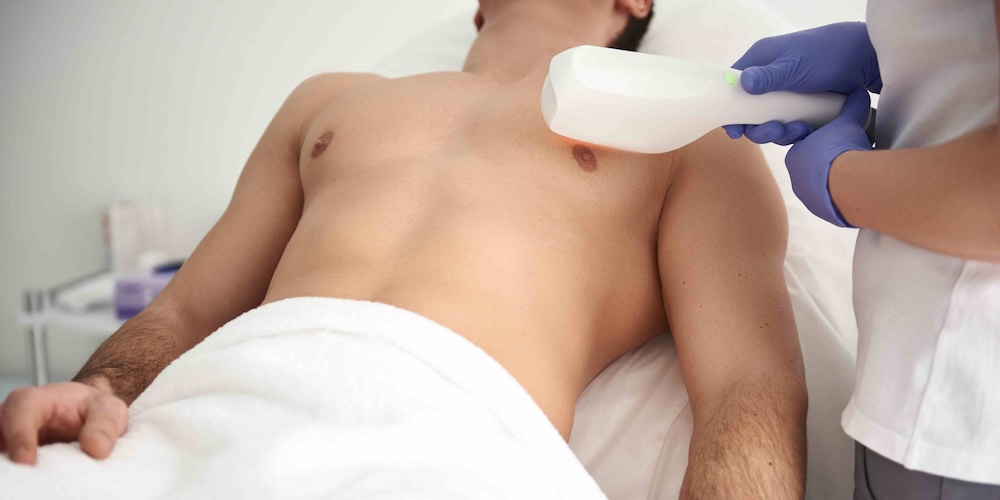 Chest Rejuvenation Treatments for Sun Damage and Wrinkles in Bethesda MD