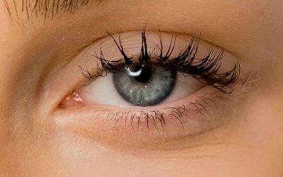 Under Eye Filler vs PRP for Rejuvenation in Bethesda, MD
