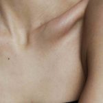 Best Treatments for Crepey Skin on the Neck and Chest in Brookville MD
