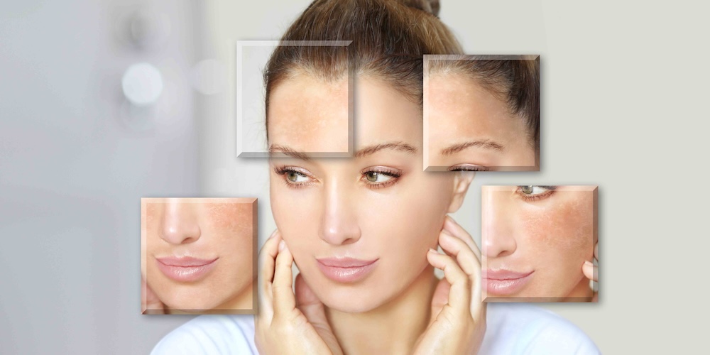 Aura 3D Facial Analysis